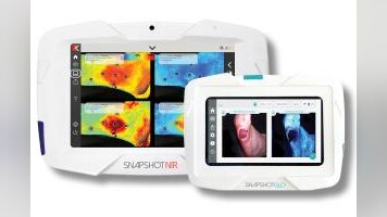 Kent Imaging’s PRISM algorithm gives clinicians an imaging-first roadmap to stop chronic wounds from failing