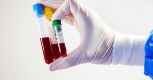 Keystone Clinic urges Singaporeans to see MCED blood tests as a supplement, not a replacement, for proven cancer screenings
